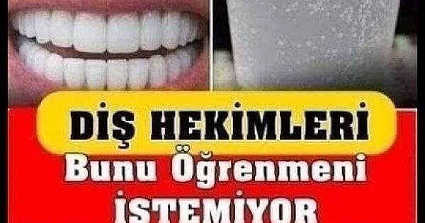  Dişçiye Gitmeden Tartar Temizlemede En Etkili 4 Yol 