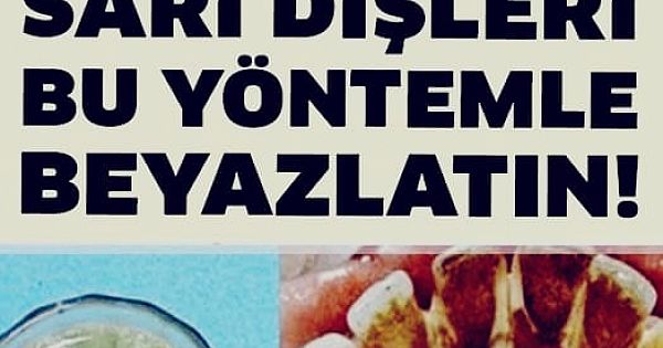 Dişçiye Gitmeden Tartar Temizlemek 