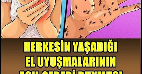 Ellerin uyuşukluğu 