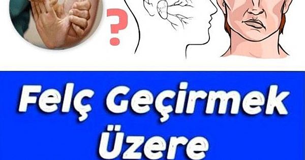 Felç Geçirmek Üzere Olduğunuzun 8 İşareti 