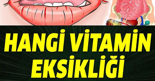 Hangi vitamin eksikliği hangi belirtileri verir? 