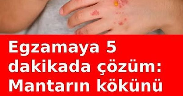 Mantarın kökünü kazıyor 