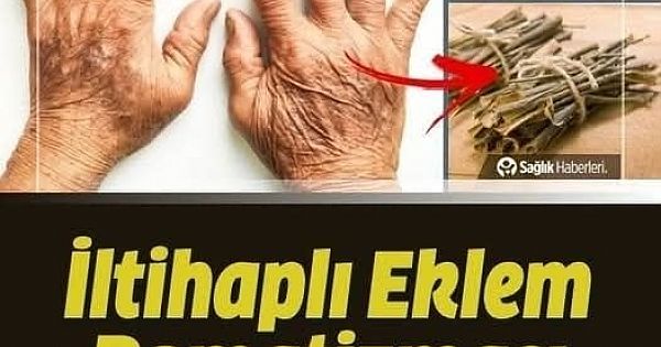 İltihaplı Eklem Romatizmasına Ne İyi Gelir 