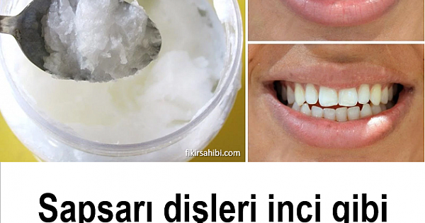 Bembeyaz Dişler