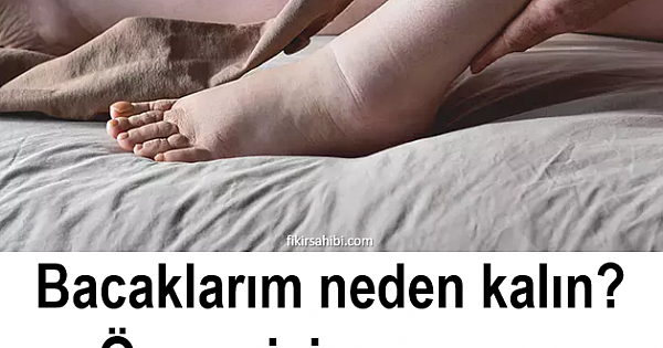 Bu Hastalığın Habercisi
