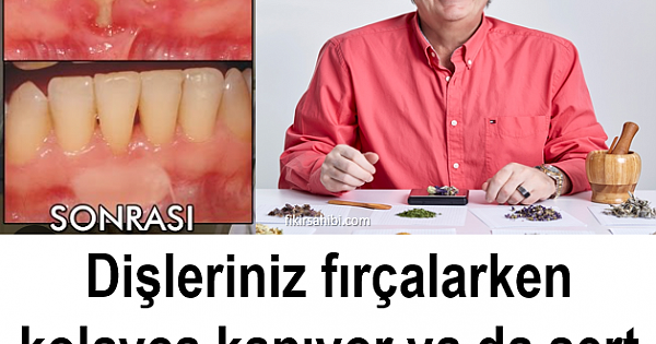 Diş Eti Çekilmesi Kürü