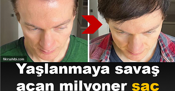 Saç Dökülmesi ve Beyazlar İçin...