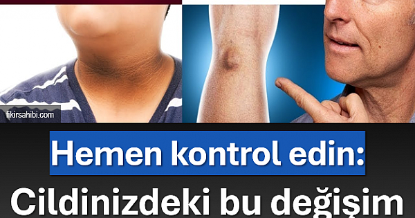 Cilt-Diyabet Bağlantısı