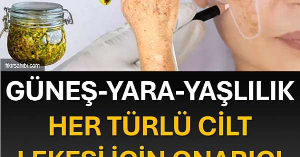 Cilt Lekeleri İçin Reçete