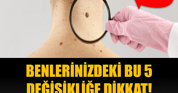 5 DEĞİŞİKLİĞE DİKKAT!