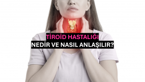 Tiroid Hastalığı Nedir ve Nasıl Anlaşılır?
