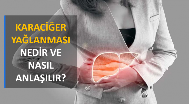 Karaciğer Yağlanması Nedir ve Nasıl Anlaşılır?