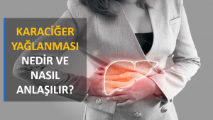 Karaciğer Yağlanması Nedir ve Nasıl Anlaşılır?
